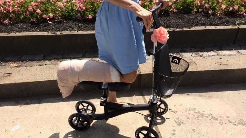 Top 10 Best knee Scooter Reviews (Buyer's Guide, 2020)