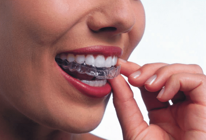 Dentek Mouth Guard
